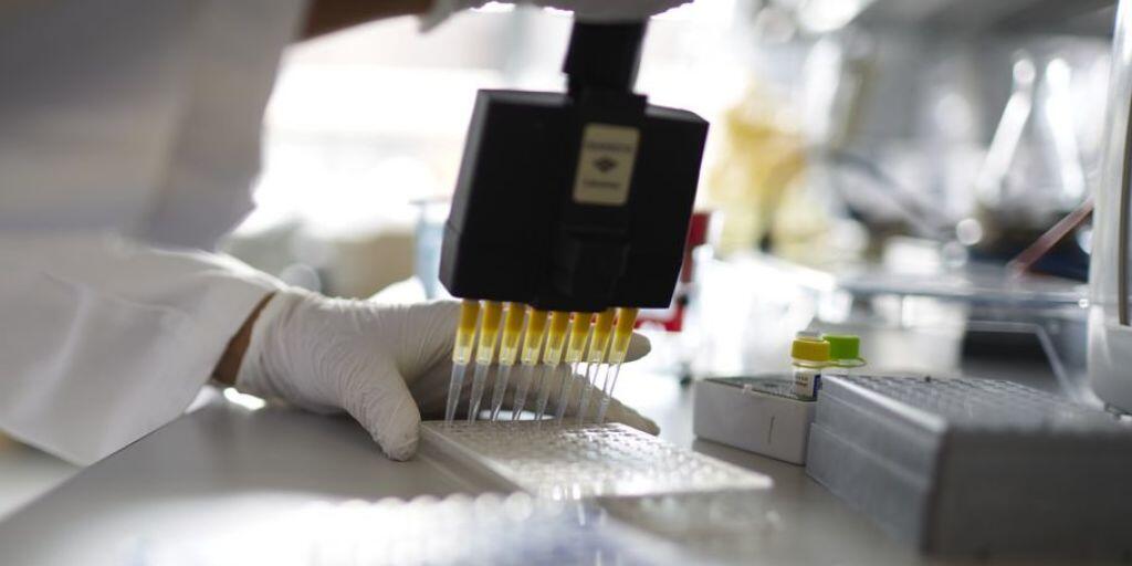 Zurzeit können HIV-Tests in der Schweiz nur im Labor durchgeführt werden, wie hier im Institut für Medizinische Virologie der Medizinischen Fakultät der Universität Zürich. (Archivbild)