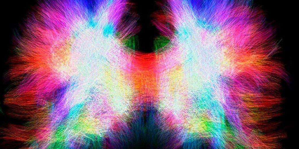 Das Corpus Callosum vermittelt die Signale zwischen den beiden Hirnhälften. Einigen Menschen fehlt dieser Balken, einige von ihnen kompensieren dies jedoch mit neuen Verbindungen in den einzelnen Gehirnhälften.