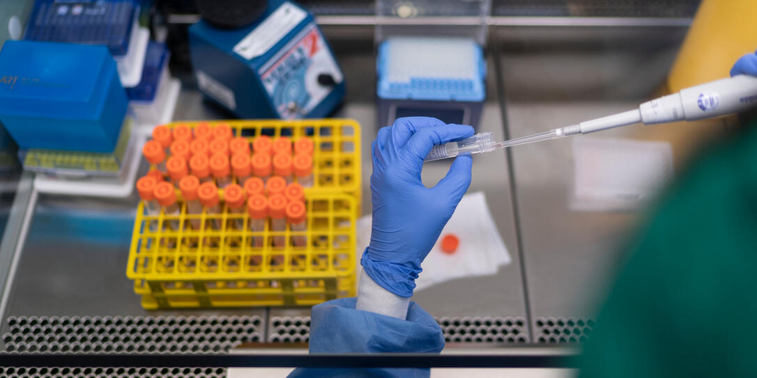 TRIEMLI, STADTSPITAL, SPITAL, LABOR, ZENTRALLABOR, LABORTAETIGKEITEN, TEST, TESTEN, TESTS, PROBE, PROBEN, CORONA-TEST, CORONA-PROBE, PCR-TEST, PCR, ANALYSE, AUSWERTUNG, CORONAVIRUS, CORONA, VIRUS, COVID-19, COVID 19, SARS-COV-2, NCOV-2019, 2019-N-COV, LAB