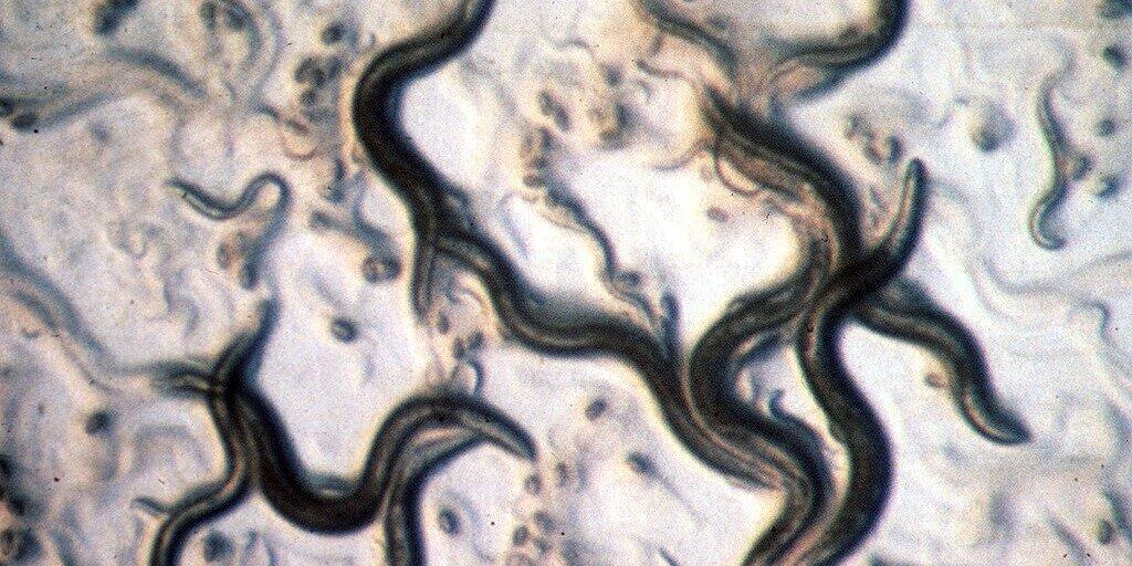 Der Fadenwurm Caenorhabditis elegans sieht bescheiden und ein bisschen eklig aus - aber er versorgt Forscher immer wieder mit Einsichten. Die neueste: Zwei Ribonukleinsäuren genügen, um aus einem ungeordneten Zellhaufen einen wohlgestalteten Embryo zu machen. (Archivbild)